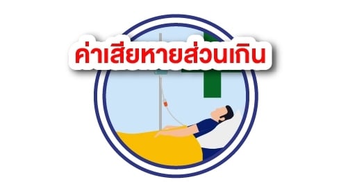 ค่าเสียหายส่วนเกิน​